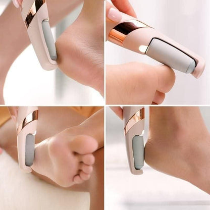 FootEase Electronic Dead Skin Remover